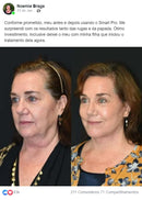 Led Facial Smart Pro - Resultados Garantidos