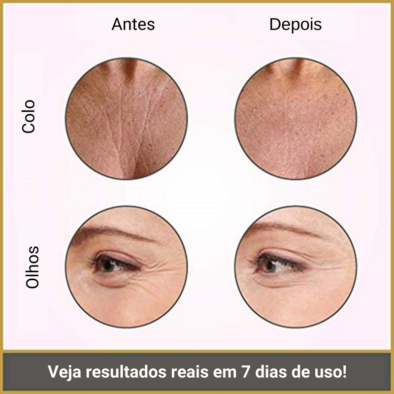 Nature Life - Adesivos Anti Antirrugas
