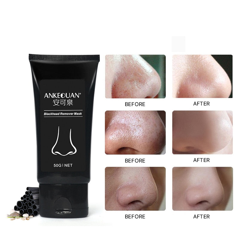 Mascara Facial Removedora de Cravos